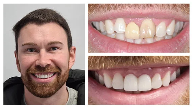 Before treatment
