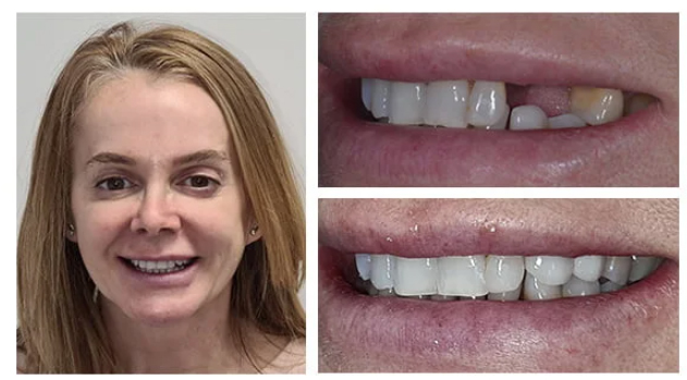 Before treatment