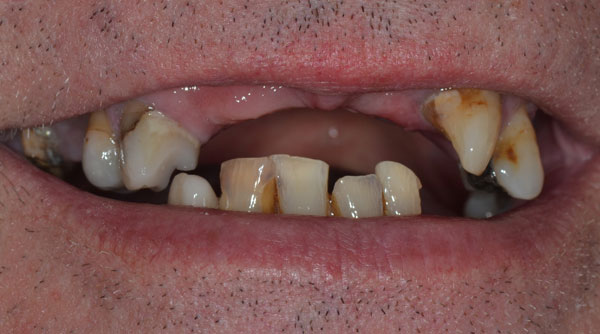 Before