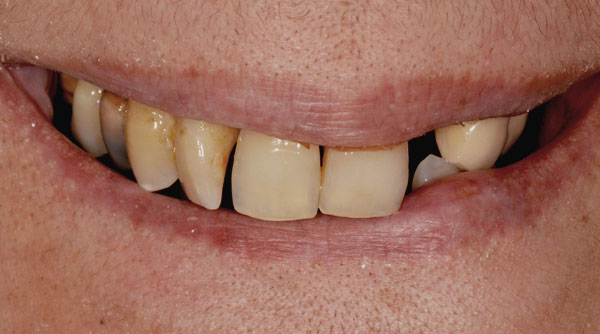 Before