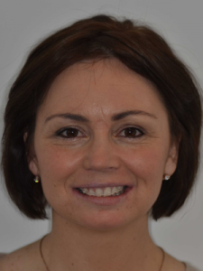 Patient wearing clear adult braces